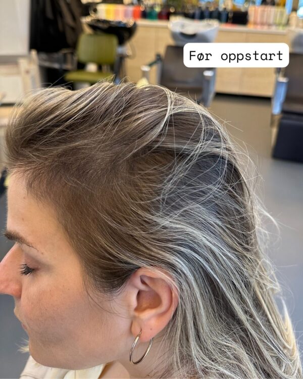 haar-nordic-resultat-for